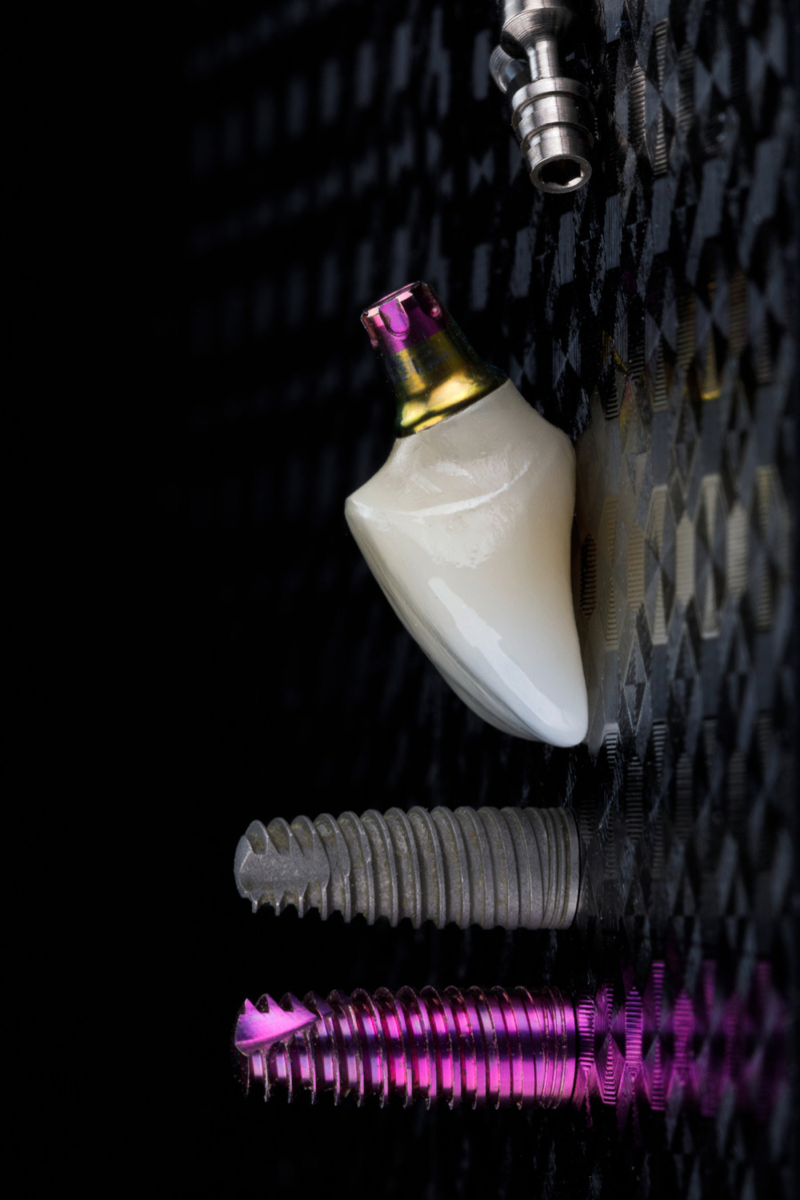 Implantes dentales